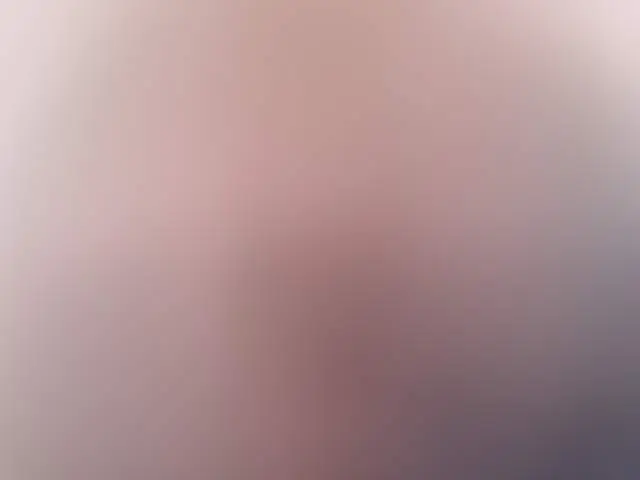 Estrellittina image 3